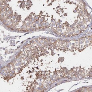 Anti-PGAP2 antibody produced in rabbit 