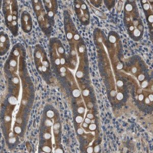 Anti-PGAP3 antibody produced in rabbit 