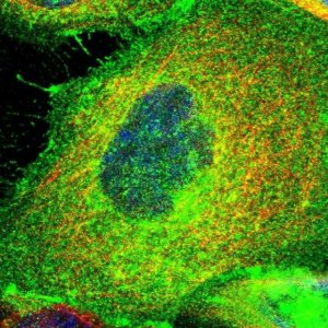 Anti-PGAP3 antibody produced in rabbit 