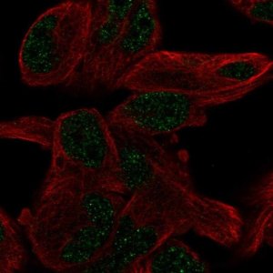 Anti-PGBD5 antibody produced in rabbit 