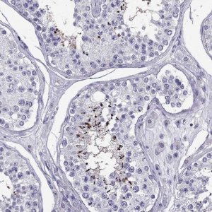 Anti-PGK2 antibody produced in rabbit 