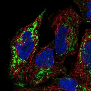 Anti-PGM2L1 antibody produced in rabbit 
