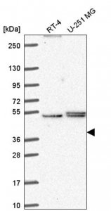 Anti-PHAX antibody produced in rabbit HPA059630-100UL