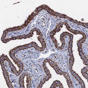 Anti-PHB2 antibody produced in rabbit HPA039874-100UL