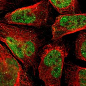 Anti-PHC1 antibody produced in rabbit 