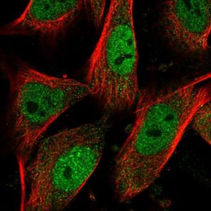 Anti-PHC2 antibody produced in rabbit 