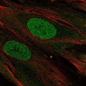 Anti-PHF11 antibody produced in rabbit 