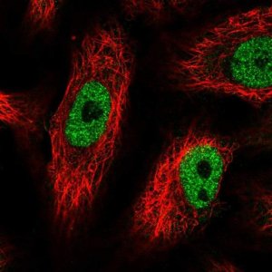 Anti-PHF12 antibody produced in rabbit 