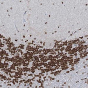 Anti-PHF2 antibody produced in rabbit 