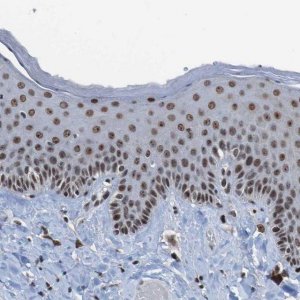 Anti-PHF2 antibody produced in rabbit 