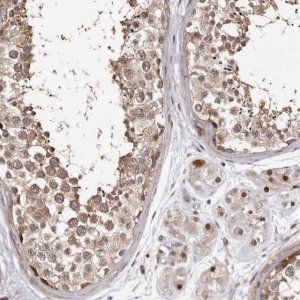 Anti-PHF20L1 antibody produced in rabbit 