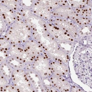 Anti-PHF21B antibody produced in rabbit 