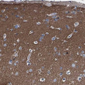 Anti-PHF24 antibody produced in rabbit 