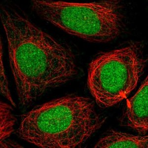 Anti-PHF8 antibody produced in rabbit 