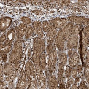 Anti-PHIP antibody produced in rabbit 