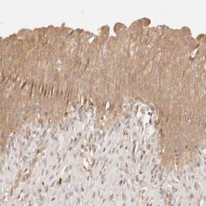 Anti-PHLDA3 antibody produced in rabbit 