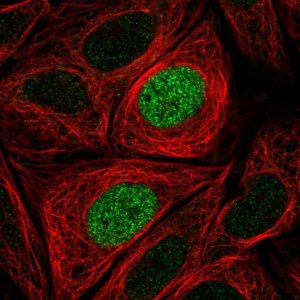Anti-PHLDB1 antibody produced in rabbit 