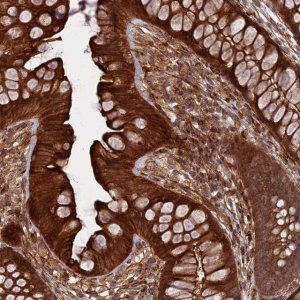 Anti-PHLDB3 antibody produced in rabbit 