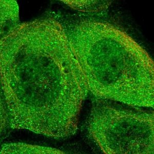Anti-PHLDB3 antibody produced in rabbit 