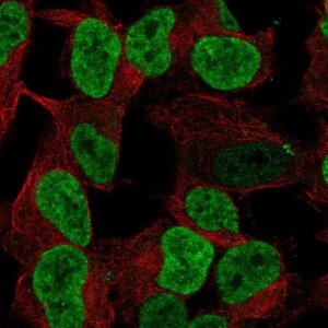 Anti-PHOX2B antibody produced in rabbit 