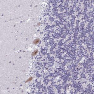Anti-PHRF1 antibody produced in rabbit 