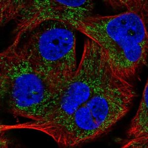 Anti-PHYHIP antibody produced in rabbit 