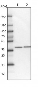 Anti-PHYKPL antibody produced in rabbit HPA036461-100UL
