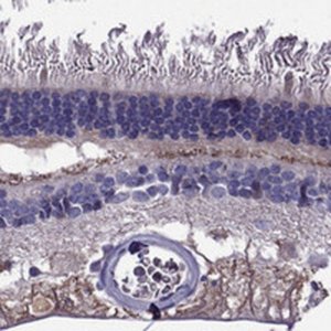Anti-PI16 antibody produced in rabbit 
