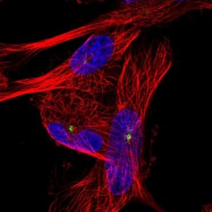 Anti-PIBF1 antibody produced in rabbit 