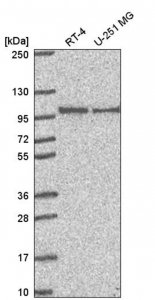 Anti-PIBF1 antibody produced in rabbit 