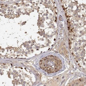 Anti-PICK1 antibody produced in rabbit 