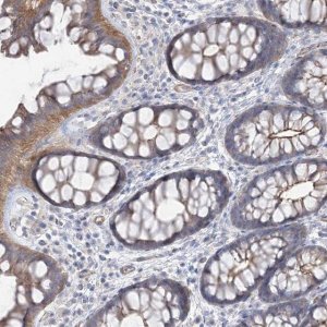Anti-PIGC antibody produced in rabbit HPA036663-100UL