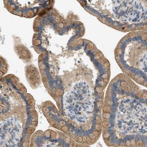 Anti-PIGG antibody produced in rabbit 