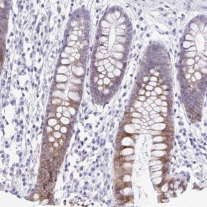 Anti-PIGK antibody produced in rabbit 