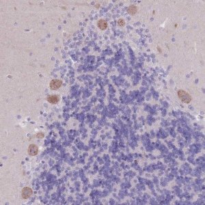 Anti-PIGM antibody produced in rabbit 