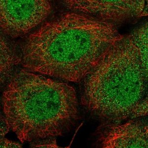 Anti-PIK3C2B antibody produced in rabbit 