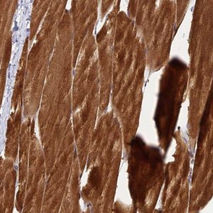 Anti-PIKFYVE antibody produced in rabbit 