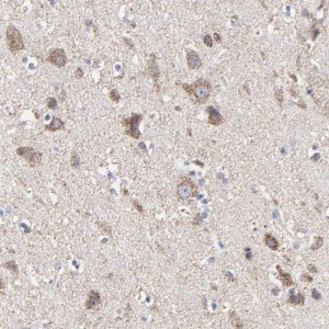 Anti-PINK1 antibody produced in rabbit 