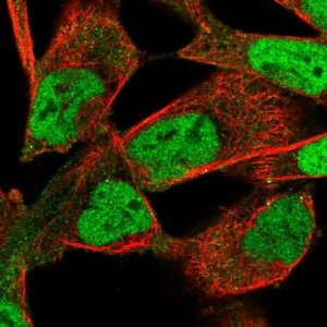 Anti-PIP4K2B antibody produced in rabbit 