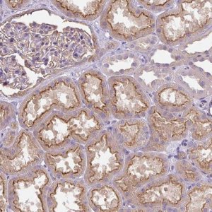 Anti-PIP5KL1 antibody produced in rabbit 