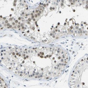 Anti-PITHD1 antibody produced in rabbit 