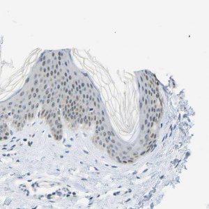Anti-PITHD1 antibody produced in rabbit 
