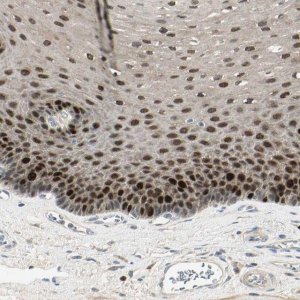 Anti-PITX1 antibody produced in rabbit 