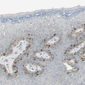 Anti-PITX1 antibody produced in rabbit 