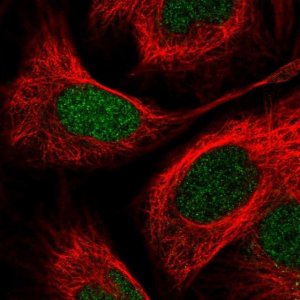 Anti-PITX2 antibody produced in rabbit 