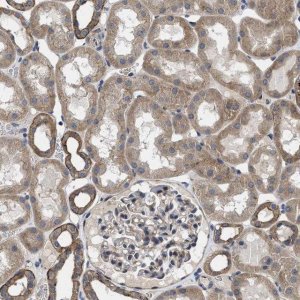 Anti-PKD2 antibody produced in rabbit 