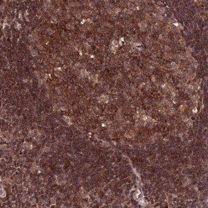 Anti-PKD2L2 antibody produced in rabbit 