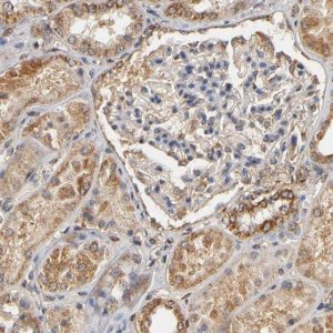 Anti-PKN1 antibody produced in rabbit 