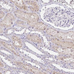 Anti-PKN3 antibody produced in rabbit 