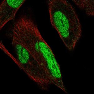 Anti-PKNOX1 antibody produced in rabbit 